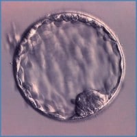 Blastocyst (embryo on day 5 after retrieval)